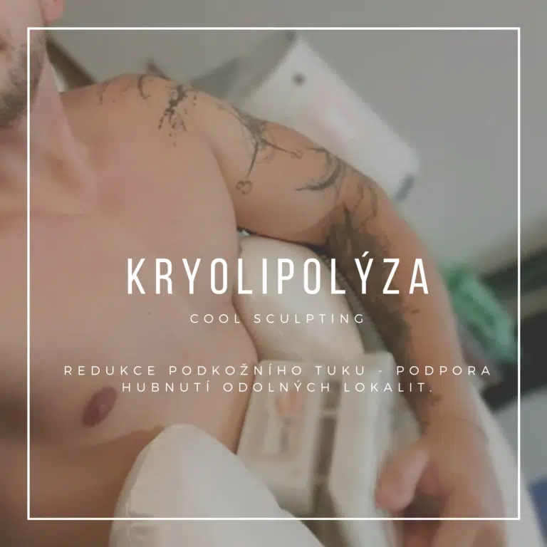 Kryolipolýza